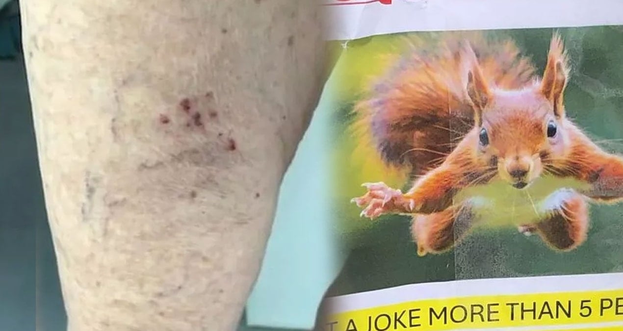 bir anda mahalleye dadandi kimse guvende degil herkes tedirgin QRuYXjQJ