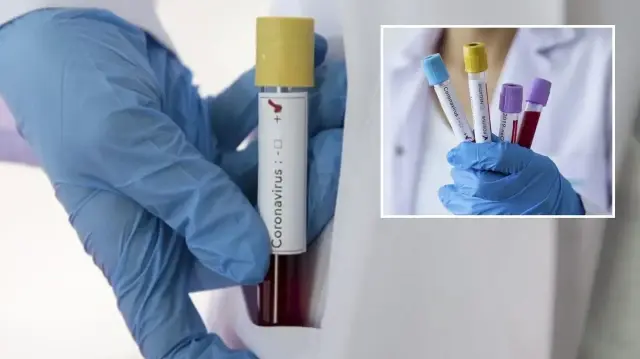 zayiflar kovid 19u daha agir geciriyor IAquaqQp.webp